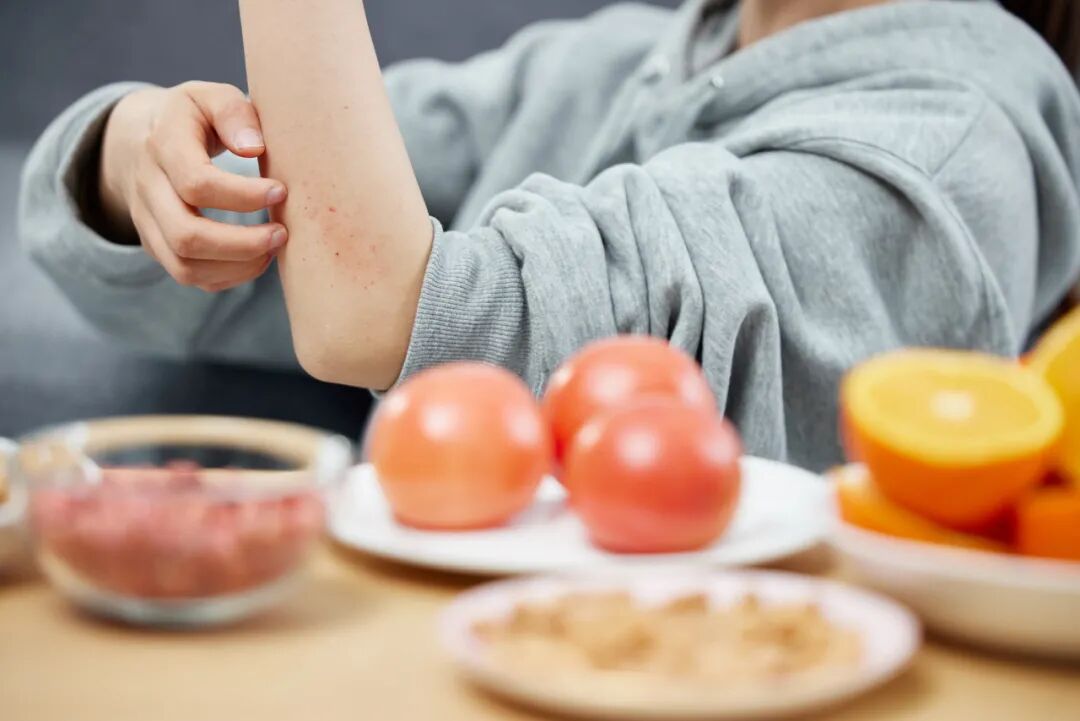 奇痒难忍 奇痒难忍