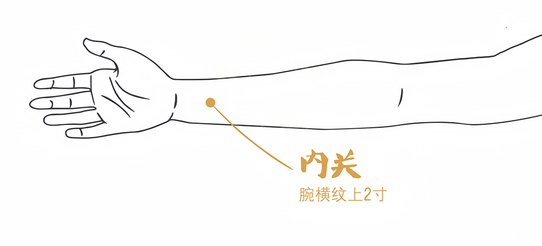 内关穴 内关穴